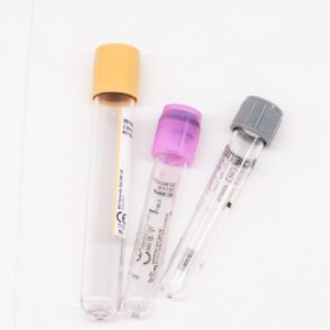 AMH-testi (Anti-Müller-hormoni)